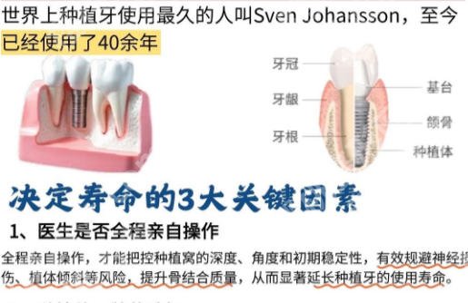 秦皇岛种牙好的医院排名公布!都是实力靠谱的口腔医院!
