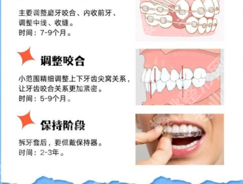 石家庄牙齿矫正大概要花费多少钱?2026正规牙科医院矫正牙收费价目表