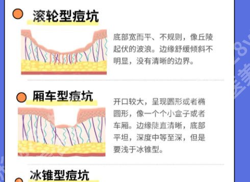 邵阳中心医院点阵激光价格怎么样?2026最新收费标准更新!