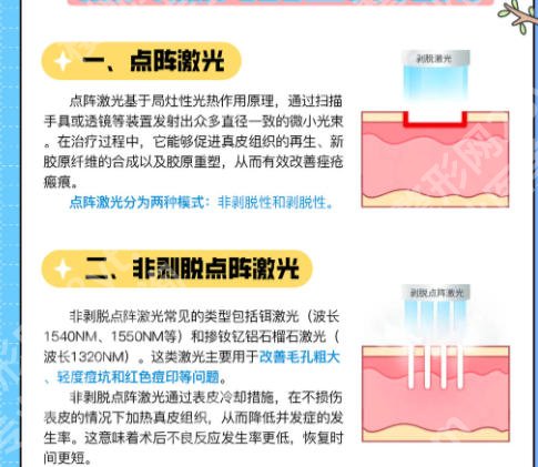 安医点阵激光多少钱？价格在2k到1w不等含医院详解及案例分析！