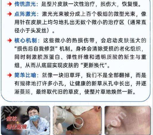 洛阳哪家医院可以做点阵激光？这几家医院实力在线等你来看！