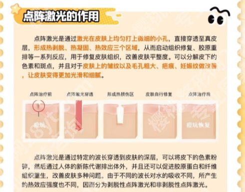 济宁点阵激光医院排名揭晓!想要在济宁做激光手术这些医院很专业!
