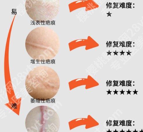 邯郸有去疤痕的医院吗?含医院详解及人气医生推荐