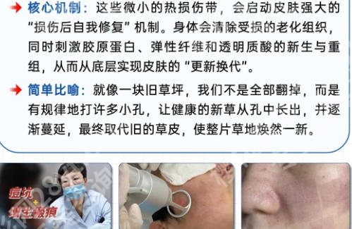 莆田点阵激光去哪个医院?top5前五家医院个个实力派