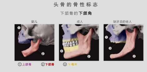 磨骨 磨骨