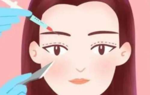 双眼皮dm2.jpg