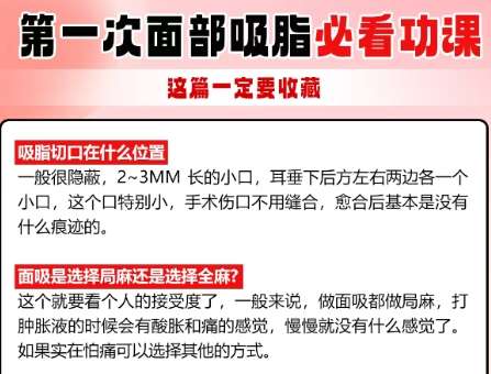 面吸 面吸