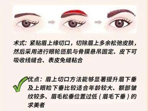 提眉 提眉