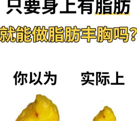 隆胸