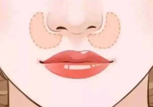 鼻4.jpg