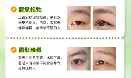 开眼角 开眼角
