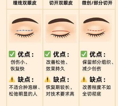 双眼皮