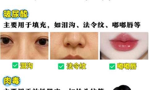 玻尿酸2.jpg