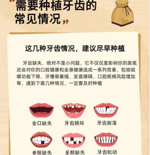 牙齿种植
