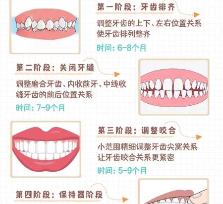 牙齿矫正