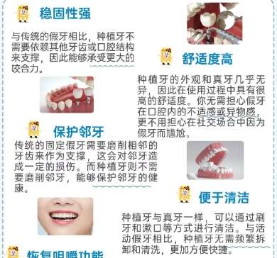 牙齿种植 牙齿种植