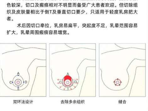 缩胸1.jpg