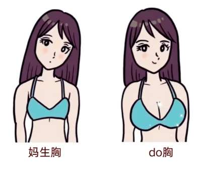 隆胸