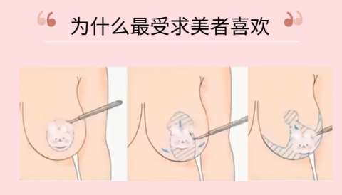 缩胸