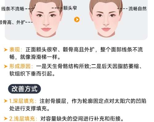 太阳穴凹陷脂肪填充.jpg