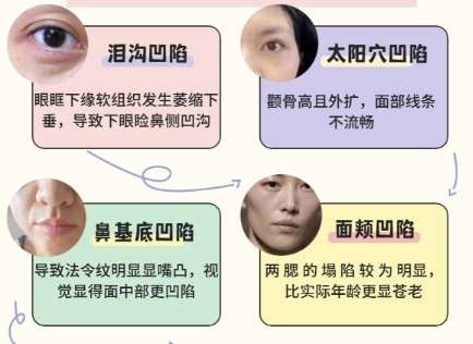 鼻基底