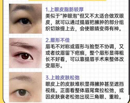 植眉3.jpg