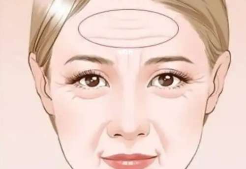 抬头纹