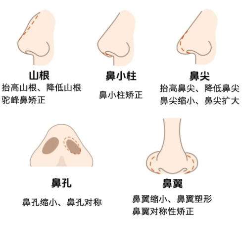 鼻综合.jpg