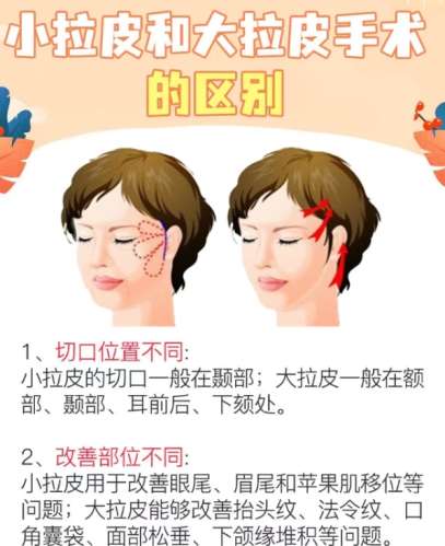 拉皮