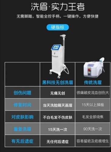 欧洲之星激光洗眉2.jpg