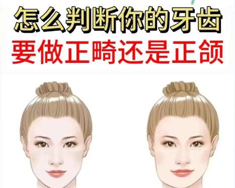正颌