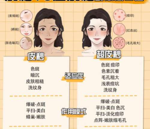 皮秒3.jpg 皮秒3.jpg