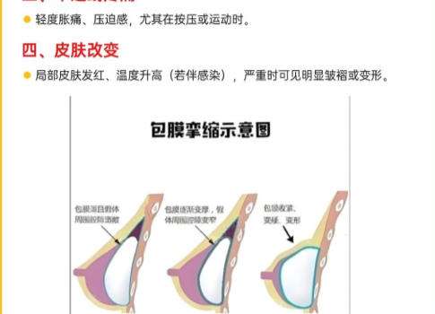 丰胸6.jpg