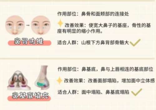 鼻综合