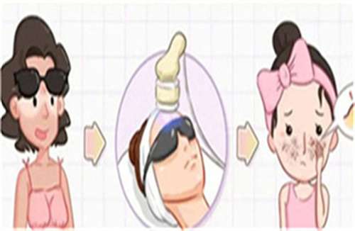 光子嫩肤7.jpg