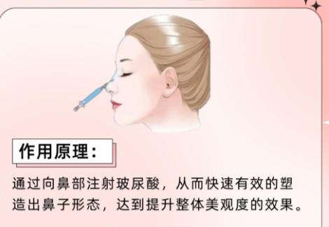 隆鼻B.jpg