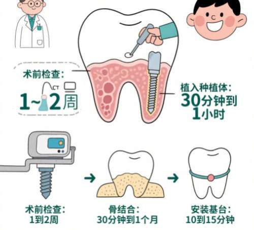牙齿种植