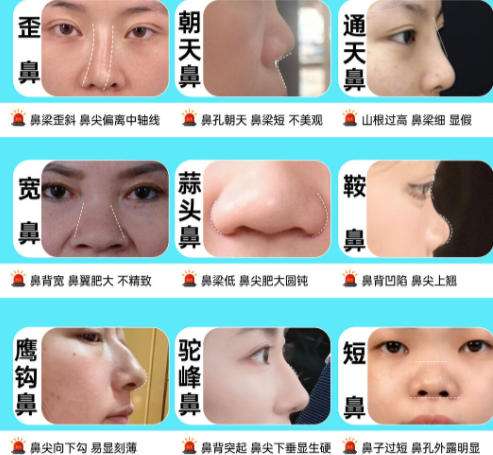 隆鼻2.jpg 隆鼻2.jpg