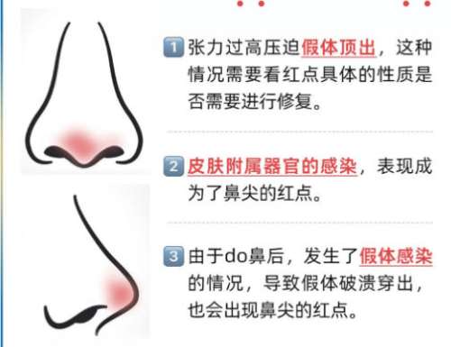 鼻修复3.jpg