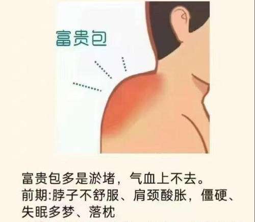 富贵包5.jpg