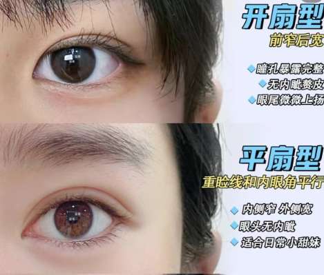 双眼皮