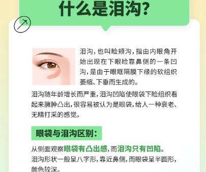 泪沟填充科普.jpg
