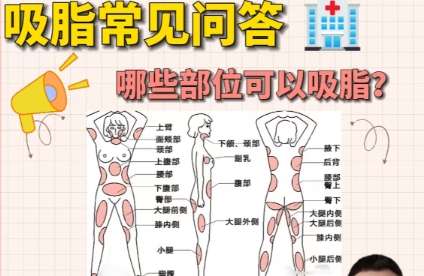 吸脂
