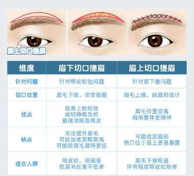 提眉