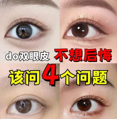 双眼皮