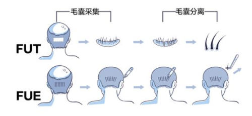 38植发.png
