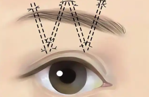 QQ截图20260305204639.png