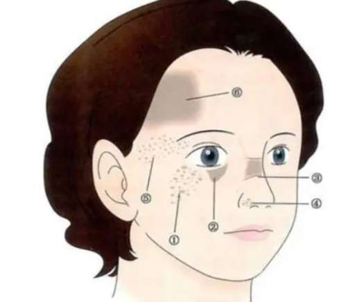 胎记 胎记