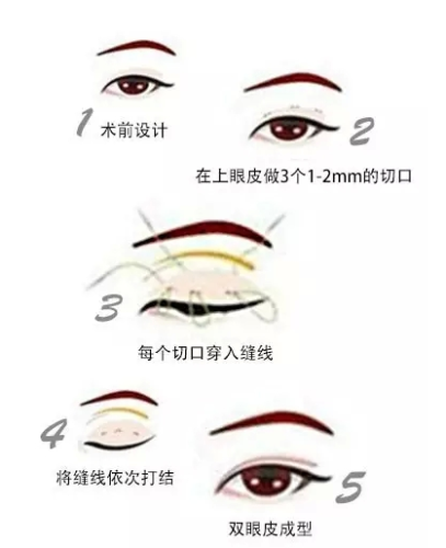 QQ浏览器截图20210908175120.png