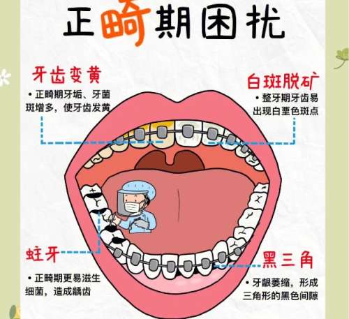 牙齿正畸